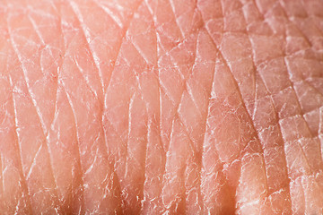 Image showing Texture of human skin