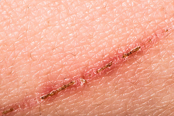 Image showing Texture of human skin and scratch