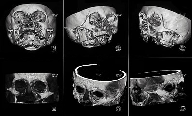 Image showing MRIs