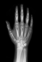 Image showing Right hand