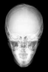 Image showing Front Face