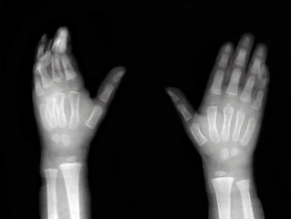 Image showing Hands