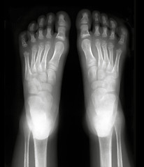 Image showing Foot