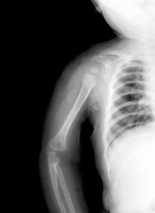 Image showing Kid shoulder