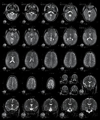 Image showing X-ray