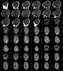 Image showing MRI