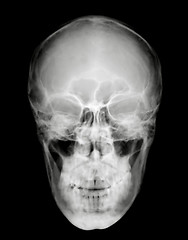 Image showing FrontHead