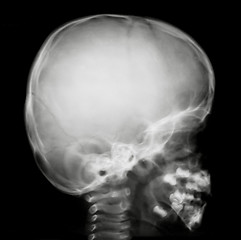 Image showing Human head