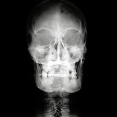 Image showing X-ray head