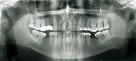 Image showing Xray mouth