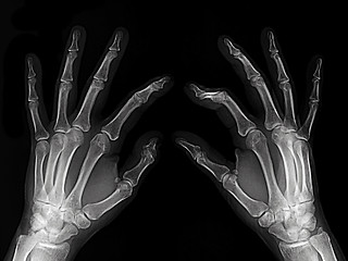 Image showing X-rayed hands