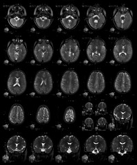 Image showing X-ray