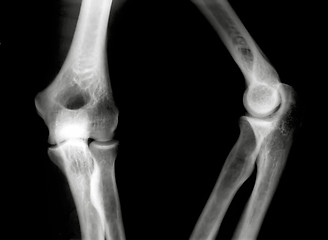 Image showing Knees