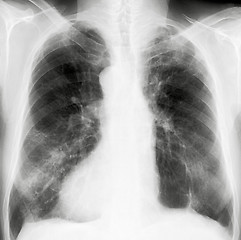 Image showing X-Ray