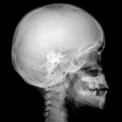 Image showing X-Ray Profile