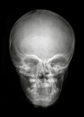 Image showing Head from front