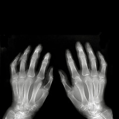 Image showing Hands