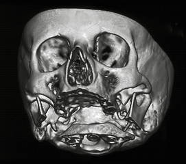 Image showing MRI