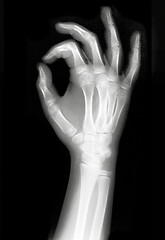 Image showing X-rayed Hand