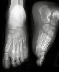 Image showing Human foots