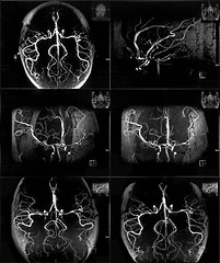 Image showing MRI scan