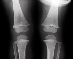 Image showing Knees