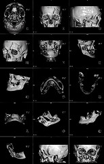 Image showing MRI of head