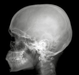 Image showing X-Ray Profile