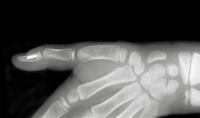 Image showing Forefinger