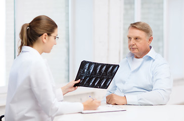 Image showing female doctor with old man looking at x-ray