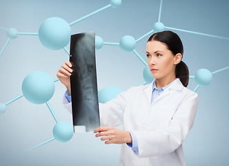 Image showing serious female doctor looking at x-ray