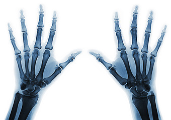 Image showing X-ray  hands