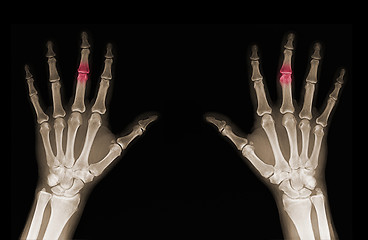 Image showing X-ray of hands