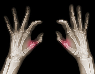 Image showing X-ray of hands