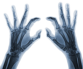 Image showing X-ray  hands