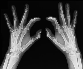 Image showing X-ray of hands