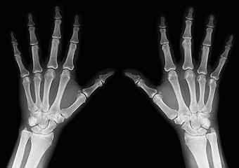 Image showing X-ray of hands