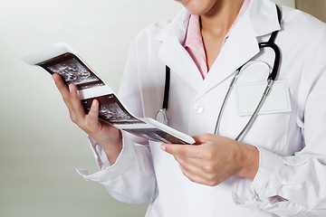 Image showing Radiologist Holding Ultrasound Print