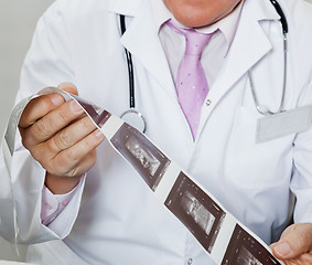 Image showing Radiologist Holding Ultrasound Print