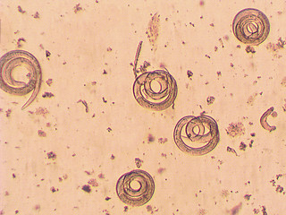 Image showing Trichinella spiralis - parasitic worm microscope