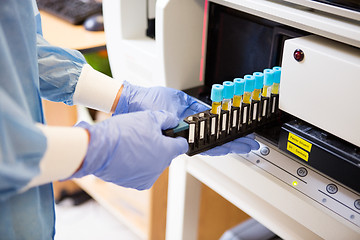 Image showing Coagulation Test Analysis