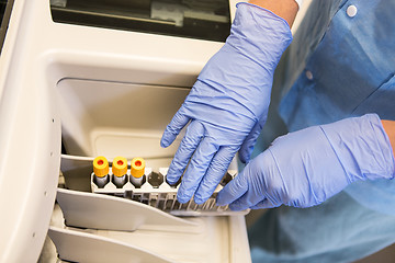 Image showing Top View Loading Samples in Chemistry Analyzer