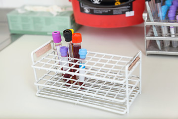 Image showing Test Tubes With Blood Samples