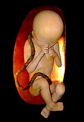 Image showing Unborn dummy