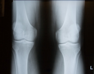 Image showing X-Ray