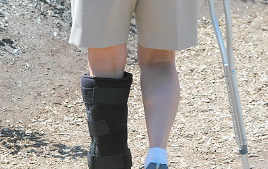 Image showing Broken Leg