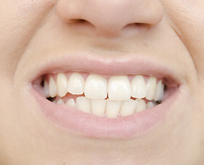 Image showing teeth