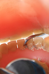 Image showing detail of dental problem 