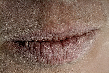 Image showing mouth