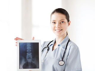 Image showing female doctor with x-ray on tablet pc